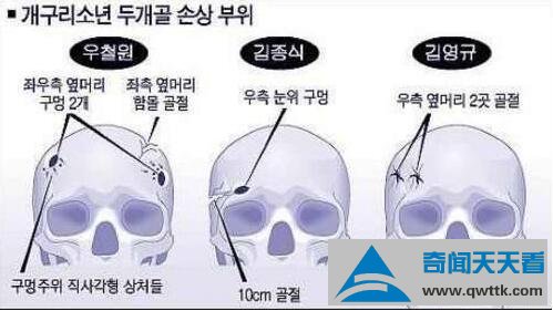 青蛙少年失踪案